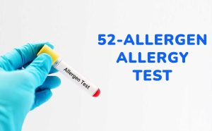 52-allergen allergy test