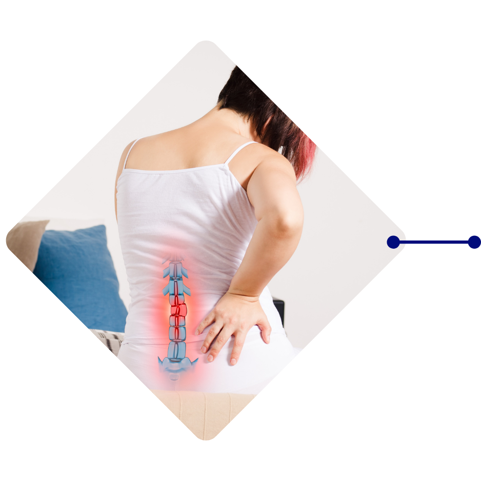 Slipped Disc