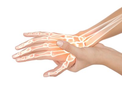 human-bone-musculoskeletal-trauma-recovery-run-fitness-sport